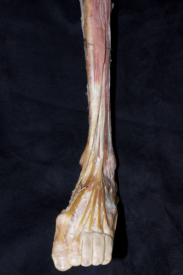 Tibialis Anterior Muscle