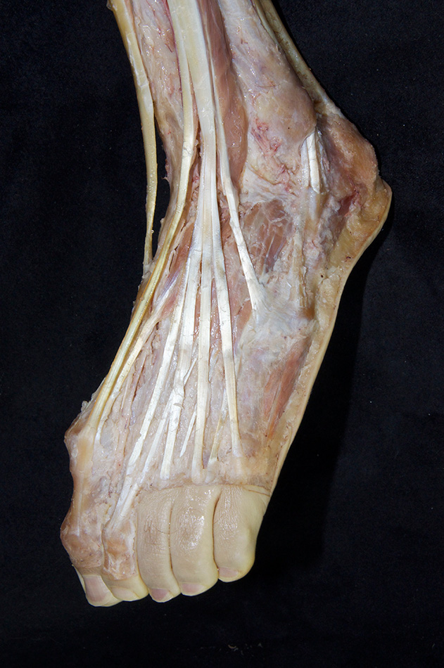 Extensor Tendons