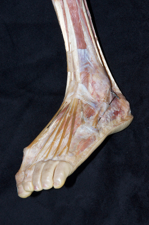 Extensor Retinacula