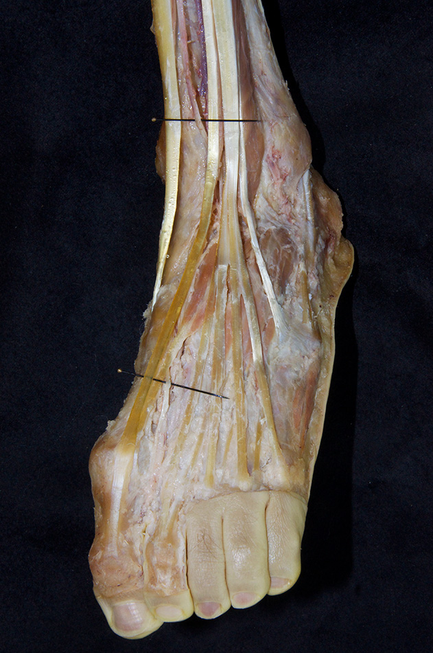 Deep Fibular Nerve