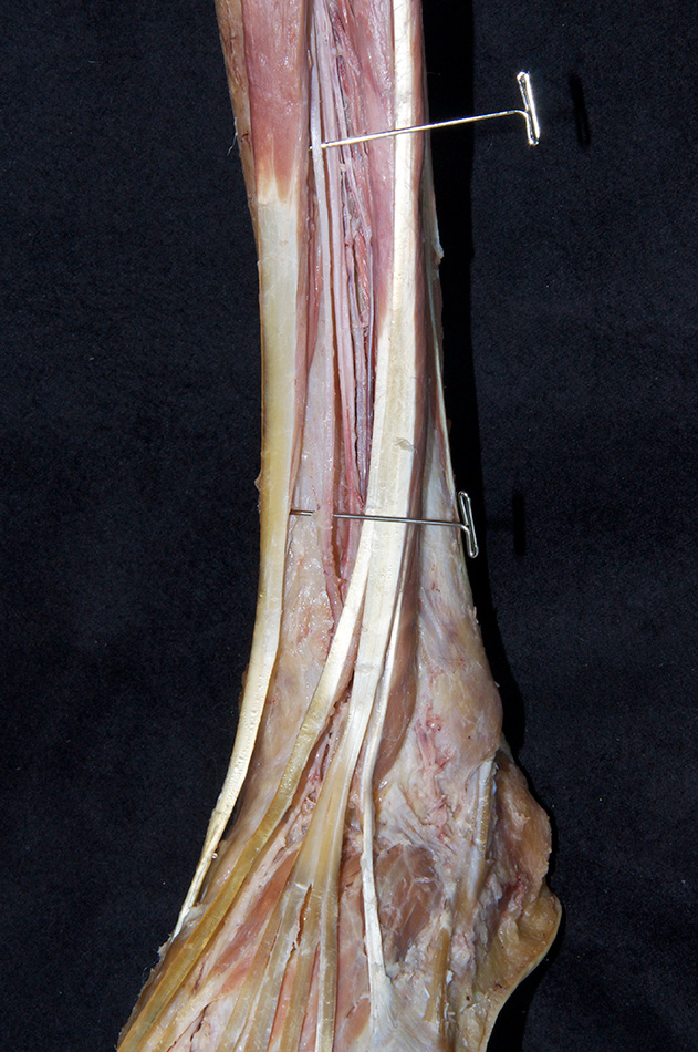 Deep Fibular Nerve