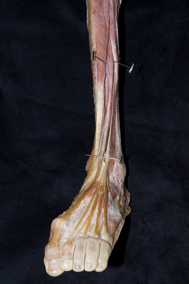 Extensor Hallucis Longus Muscle