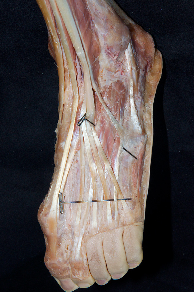 Extensor Digitorum Brevis Muscle