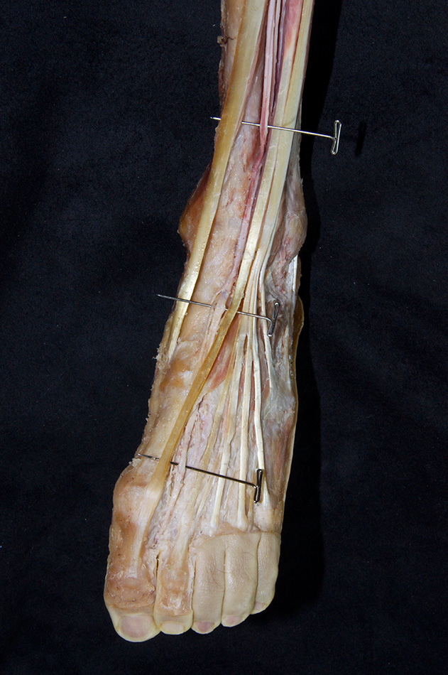 Dorsalis Pedis Artery