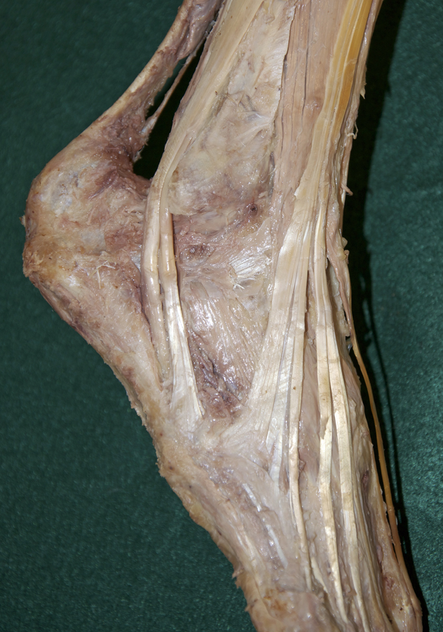 Tendons at Lateral Malleolus