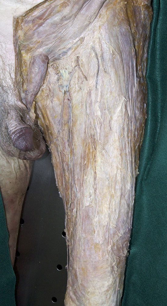 Fascia Lata