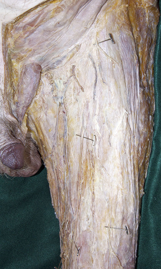 Cutaneous Nerves of Anterior Thigh