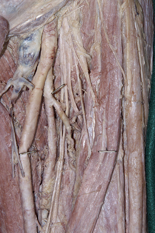 Lateral Circumflex Femoral Artery