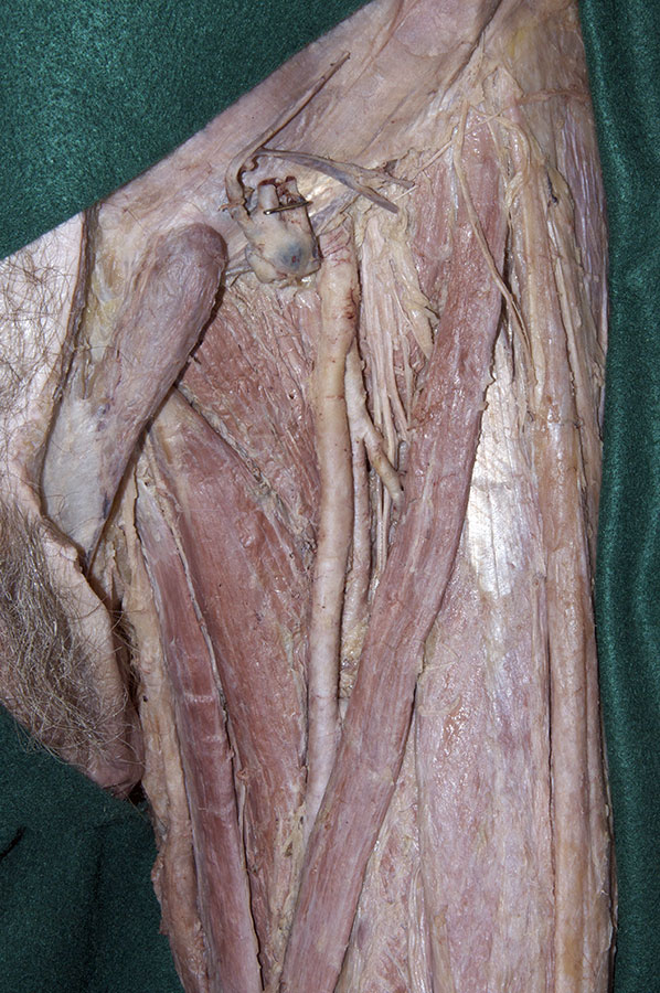 Adductor Longus Muscle