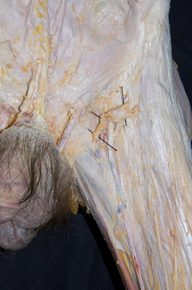 Superficial Inguinal Lymph Nodes