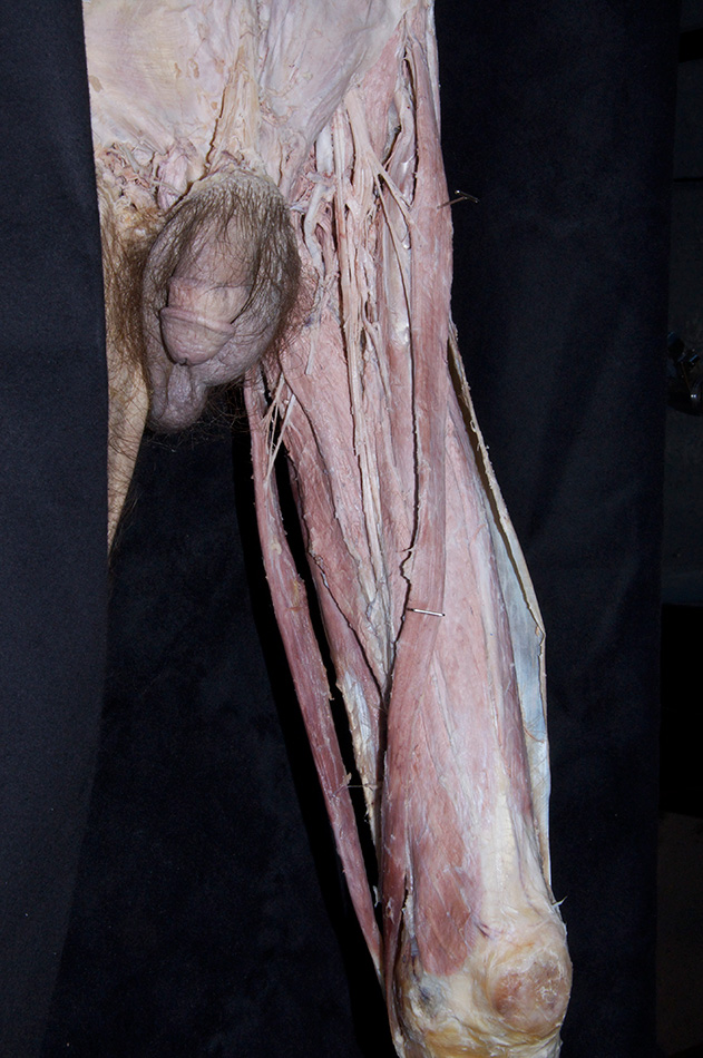 Sartorius Muscle