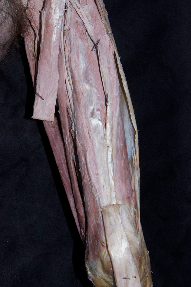 Quadriceps Femoris Muscle