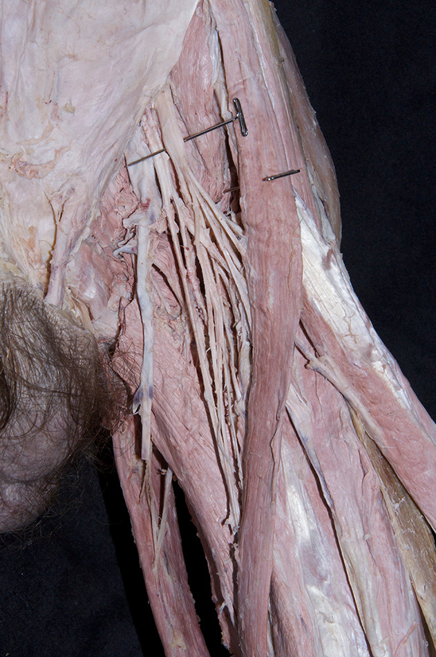 Femoral Nerve