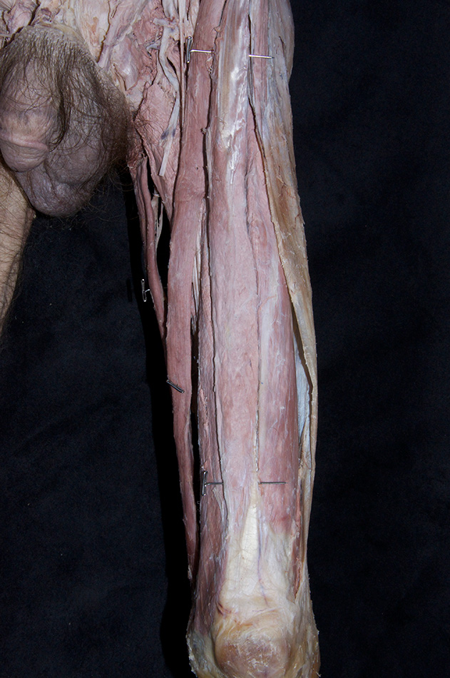 Rectus Femoris Muscle