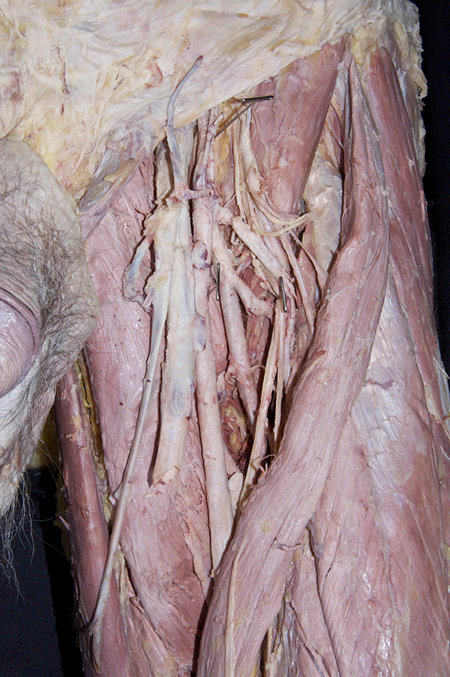 Profunda Femoris Artery