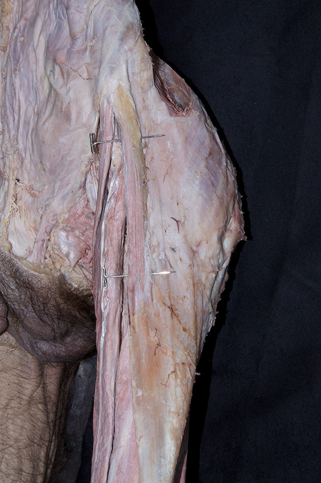 Iliotibial Tract
