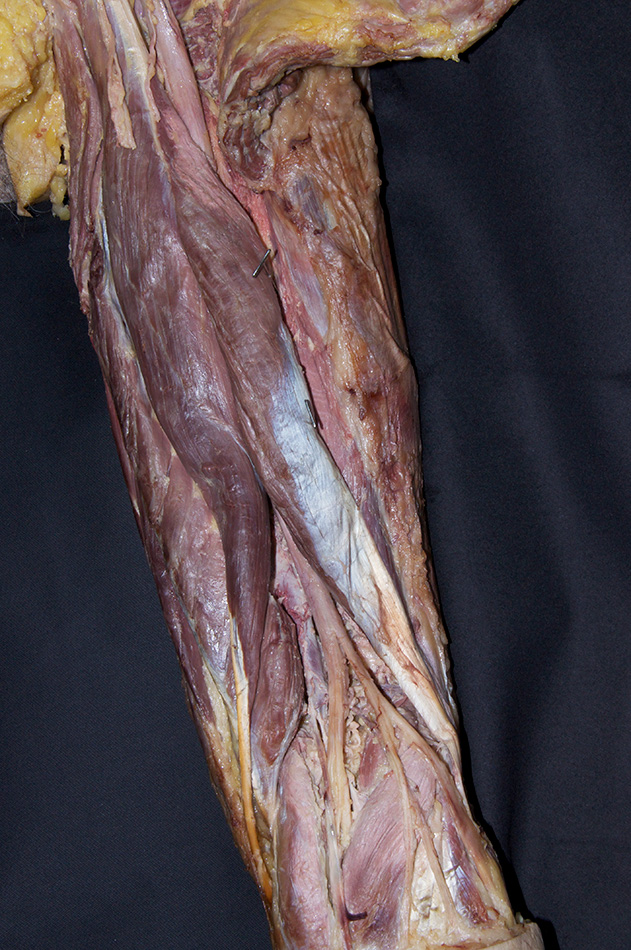 Biceps Femoris Muscle