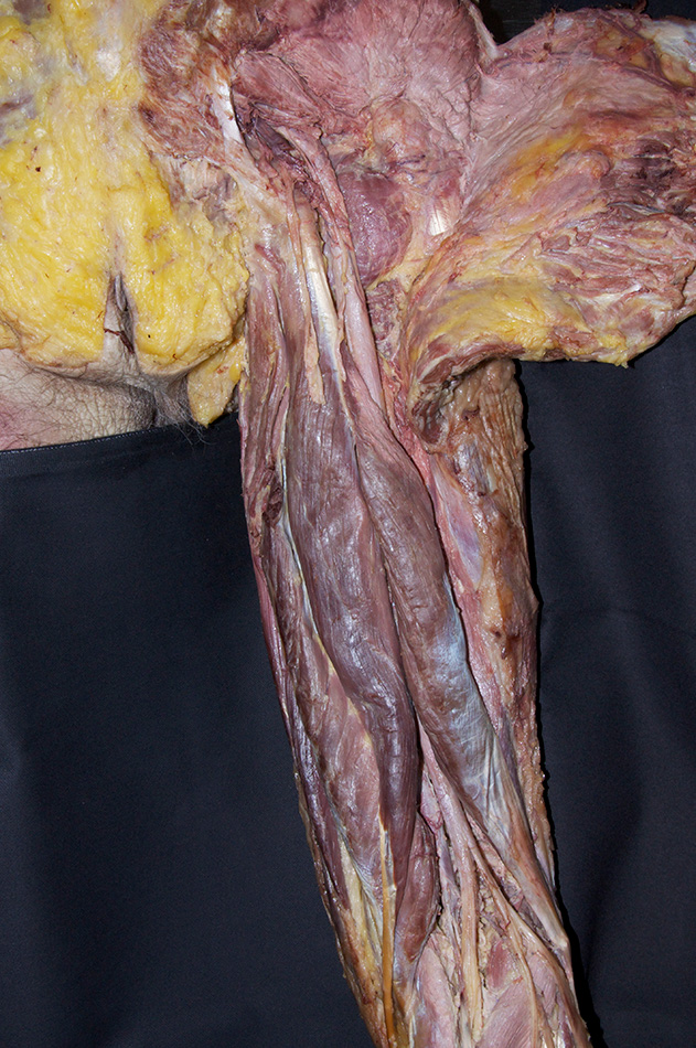 Semitendinosus and Semimembranosus Muscles