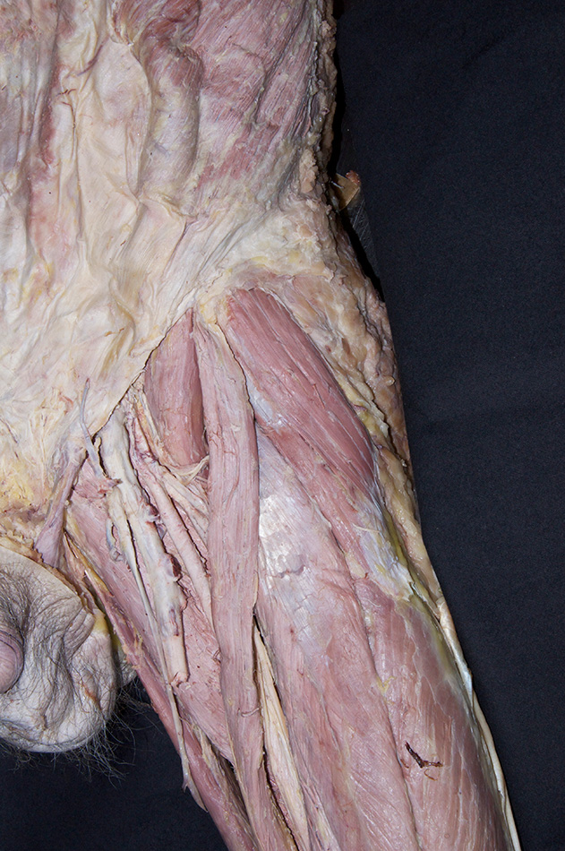 Tensor Fasciae Latae Muscle