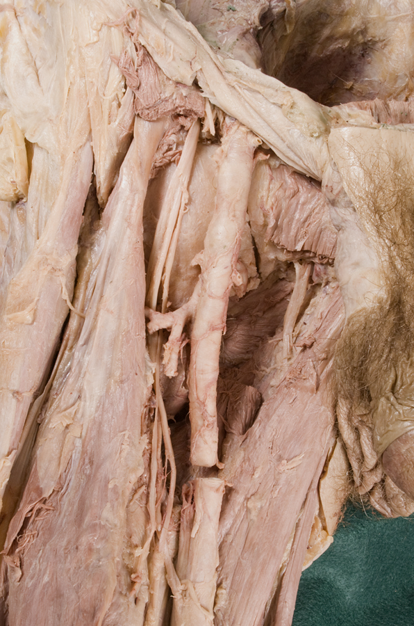 Anterior Hip