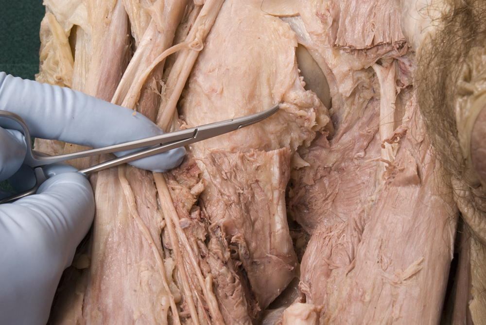 Iliofemoral Ligament