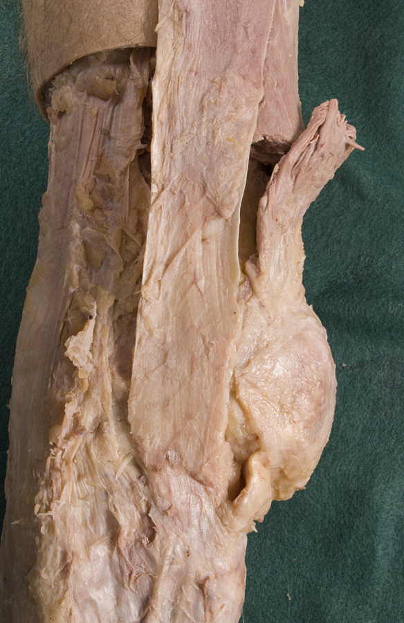 Lateral Knee