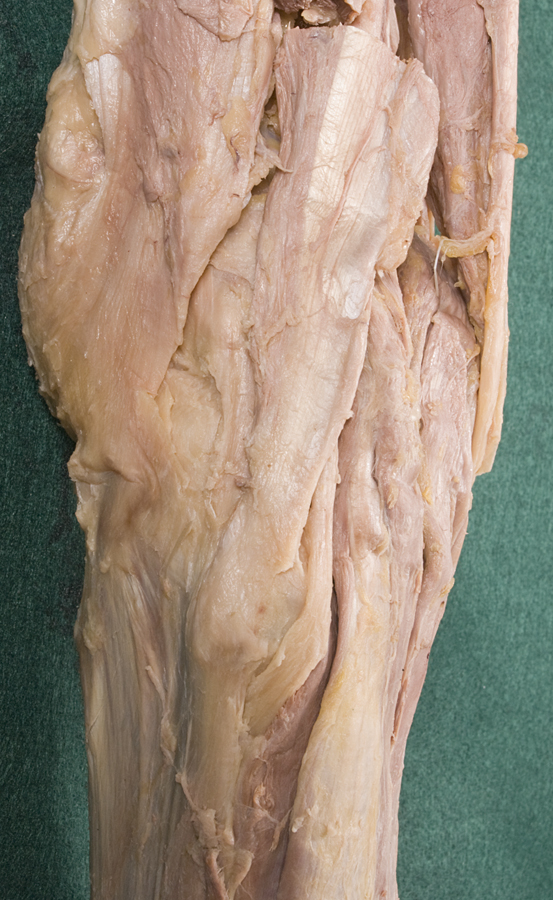Biceps Femoris Tendon