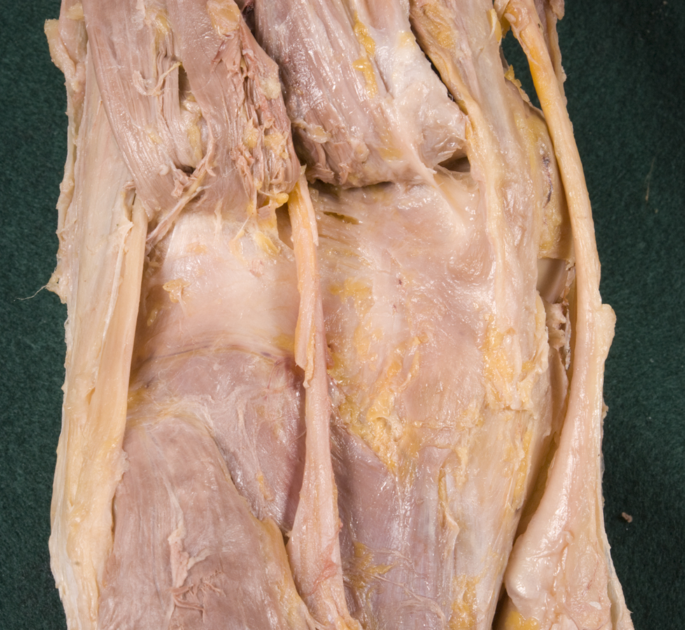 Posterior Knee
