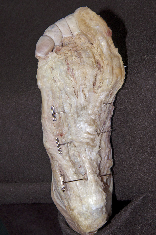 Plantar Aponeurosis