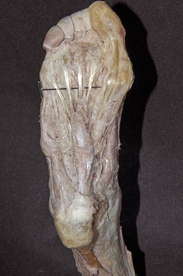 Plantar Muscles (First Layer)
