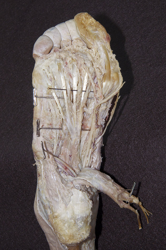 Plantar Muscles (Second Layer)