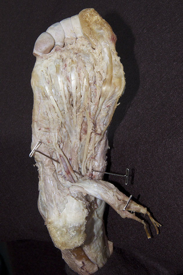 Plantar Nerves and Arteries
