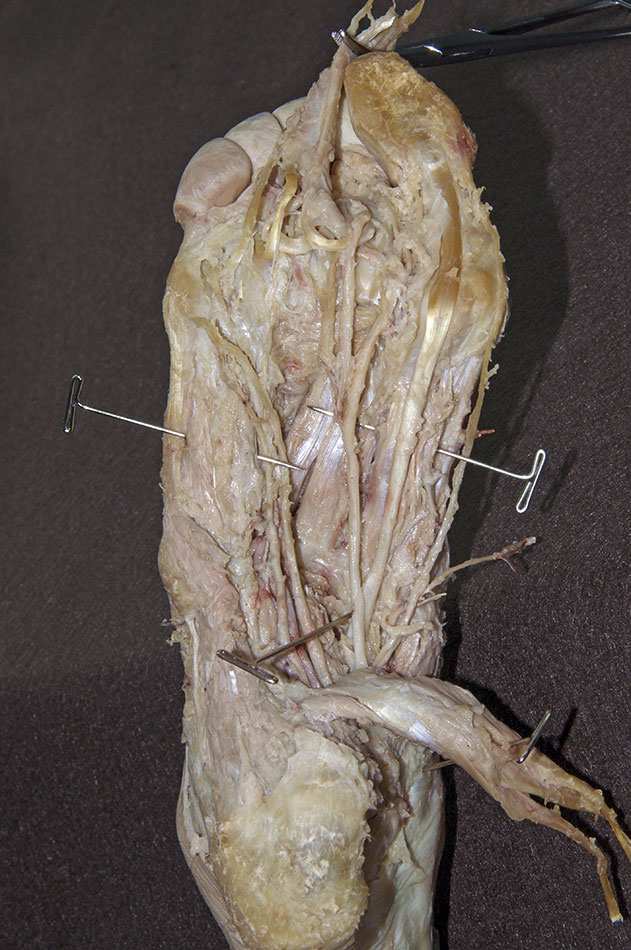 Plantar Muscles (Third Layer)