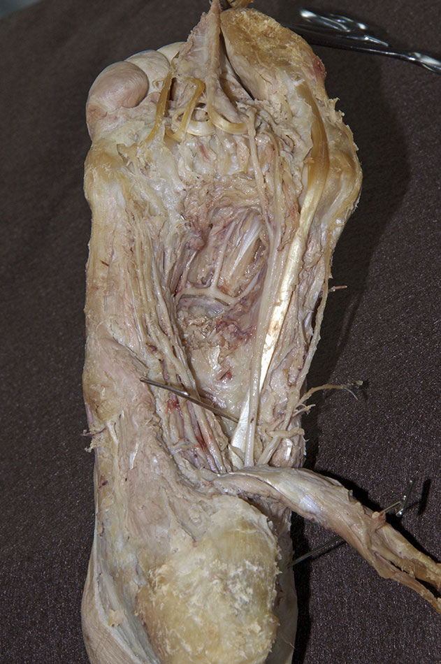Deep Plantar Arterial Arch