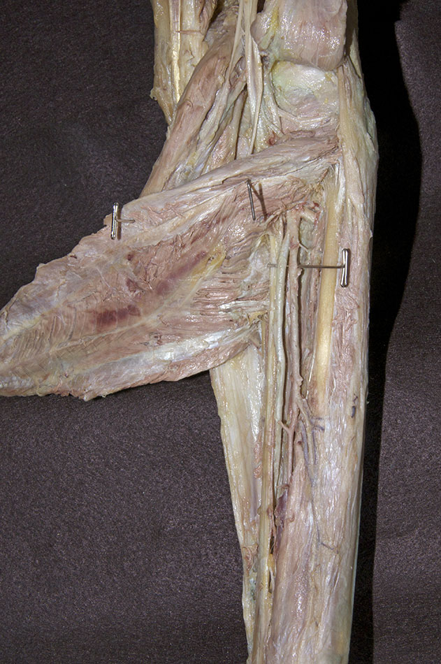 Posterior Tibial Artery