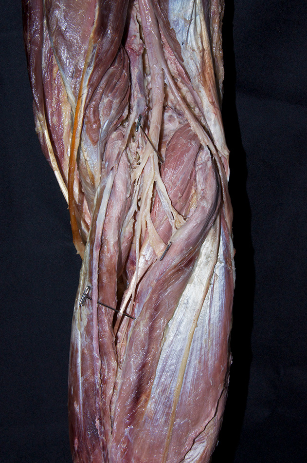 Plantaris Muscle