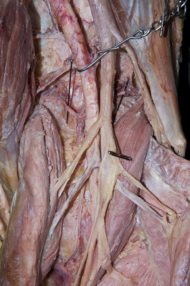 Superior Genicular Arteries