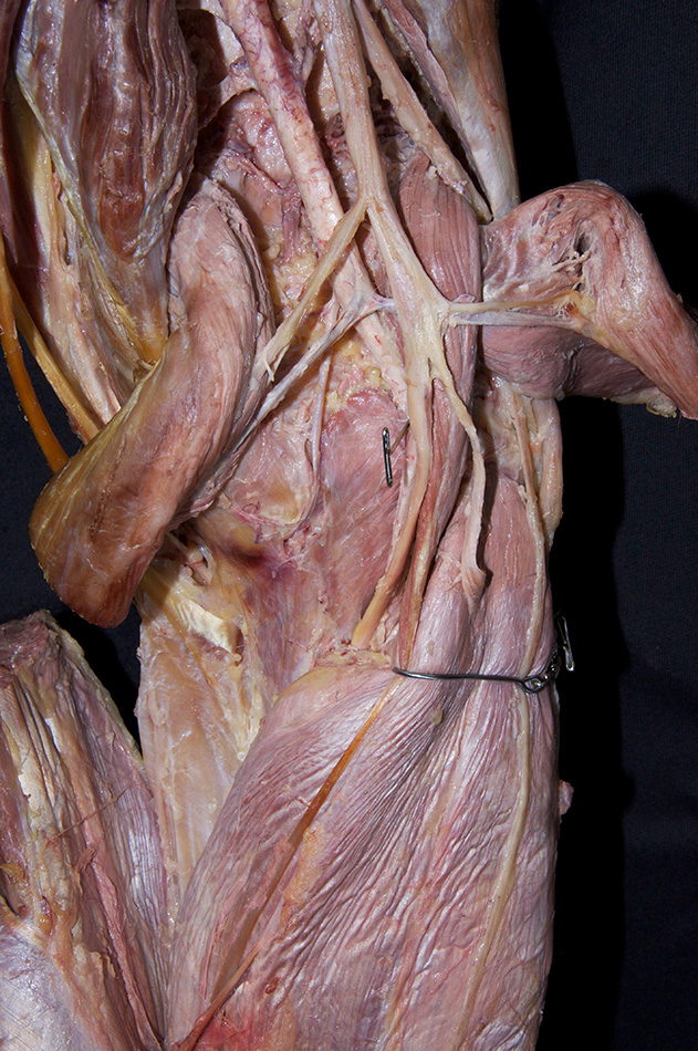 Popliteus Muscle