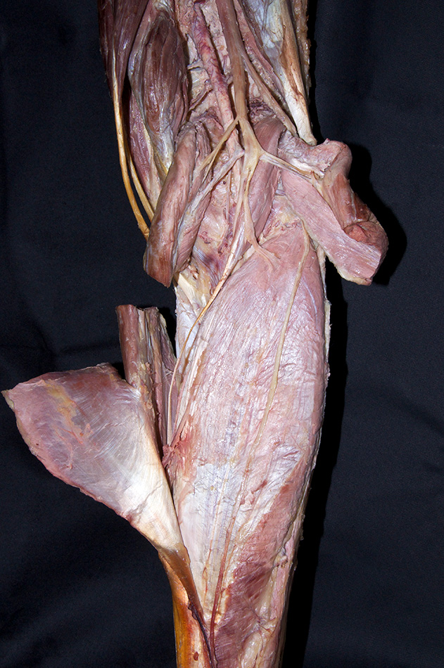 Soleus Muscle