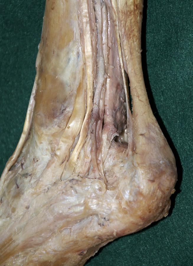 Tendons at Medial Malleolus
