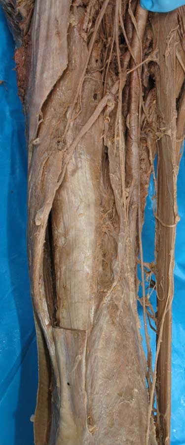 Anterior Thigh - 2