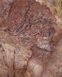Superior Gluteal Structures