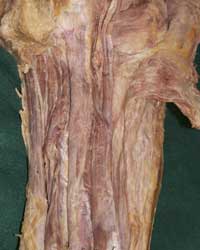 Proximal Posterior Thigh