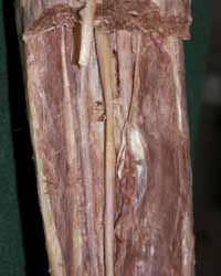 Deep Posterior Leg