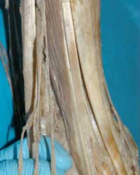 Distal Anterior Leg