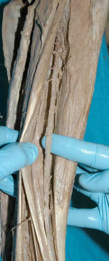 Anterior Leg - 2