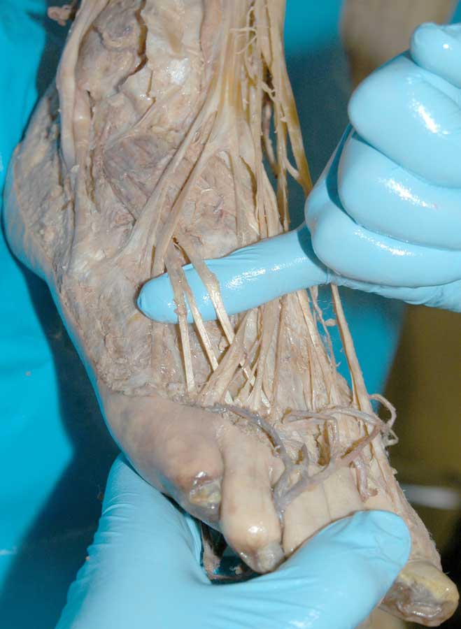 Dorsal Foot - 2