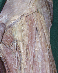 Deep Anterior Thigh