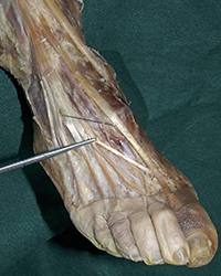 Deep Dorsal Foot