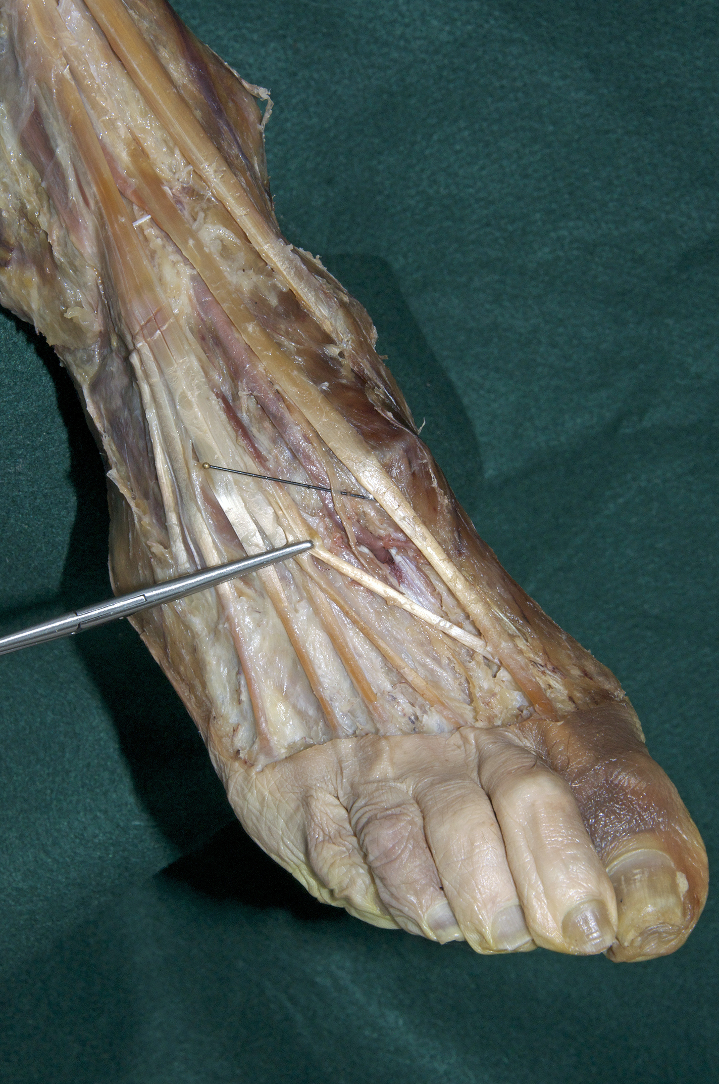 Dorsal Foot - 6